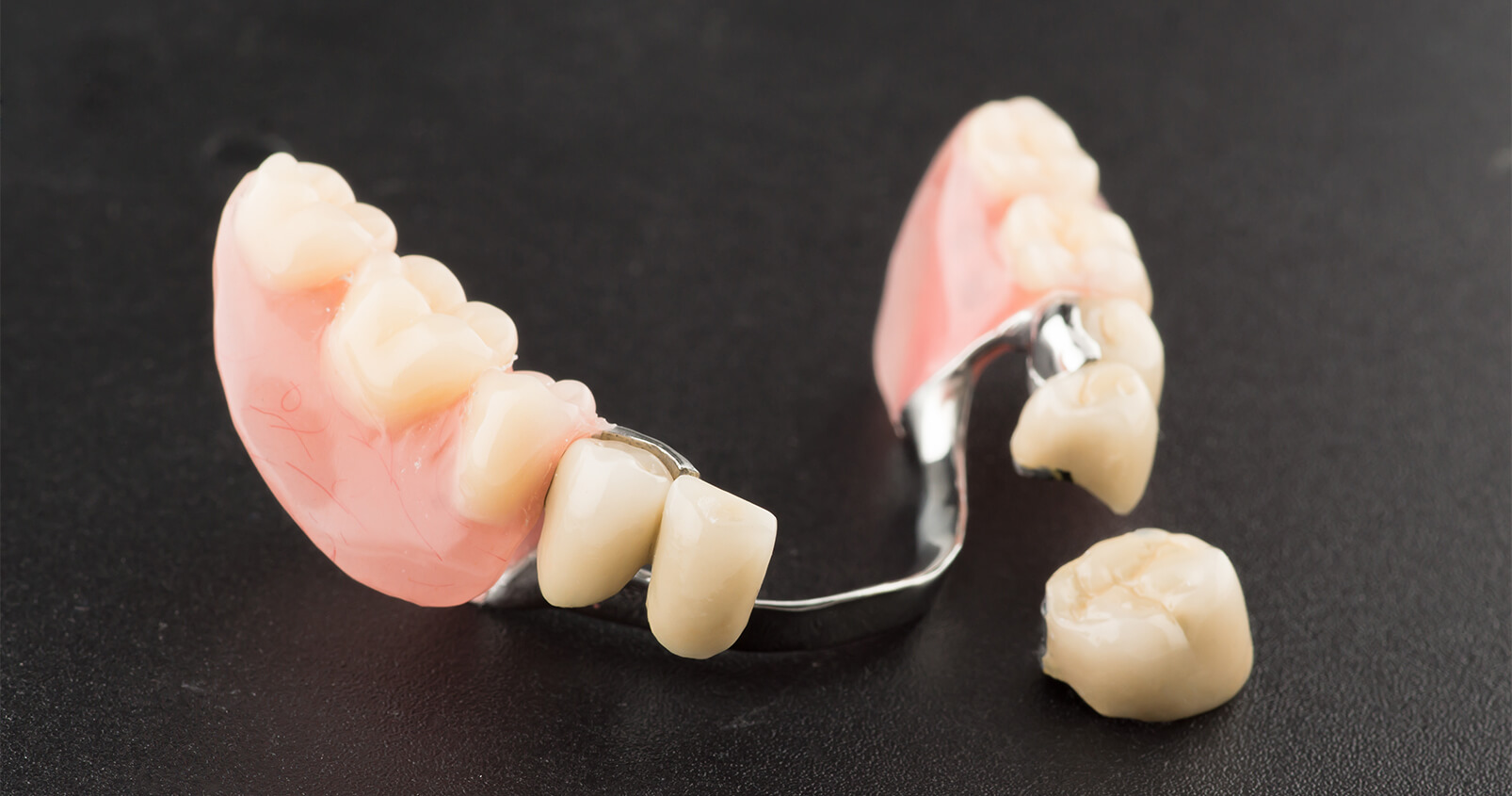 Removable Partials and Dentures Azusa - Restorative Dental